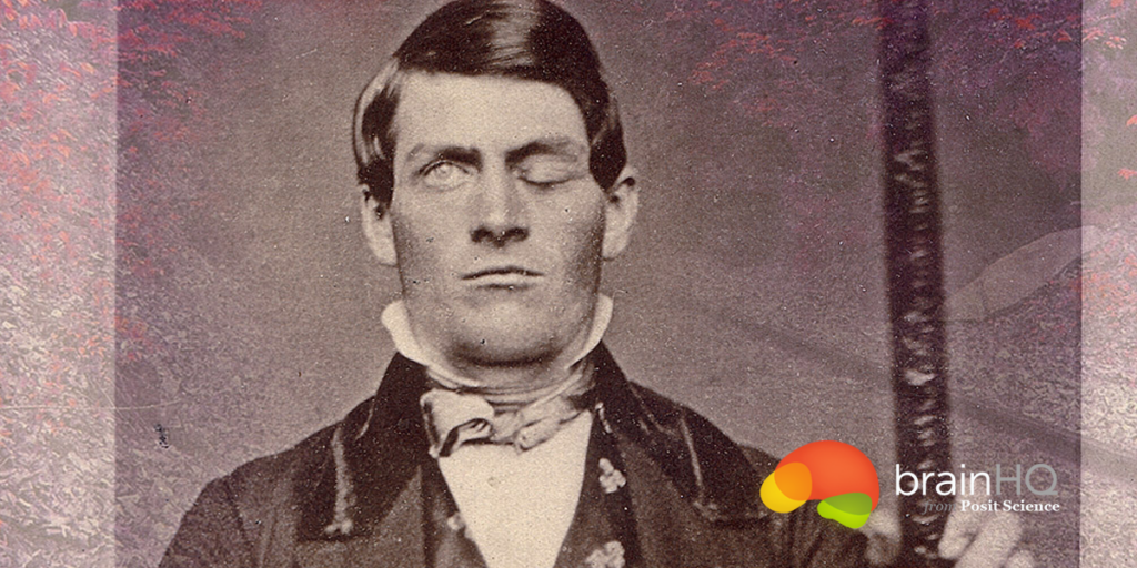 The Strange Tale Of Phineas Gage
