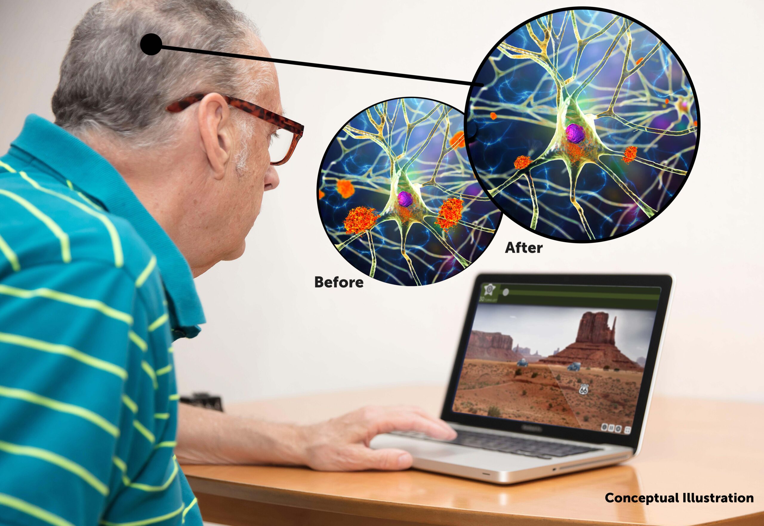 New study: Brain training lowers levels of a hallmark of Alzheimer’s